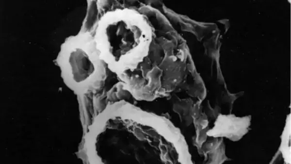 Амеба, поедающая мозг, убита наночастицами серебра