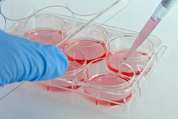 ВИЧ элиминируется в культуральной среде