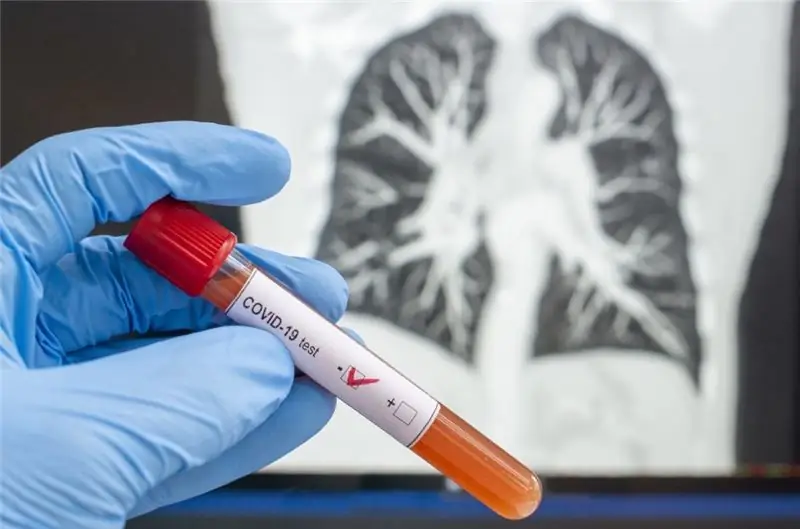 пандемия в лаборатории легких