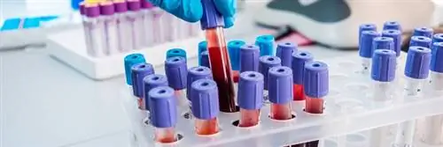 Группа крови O вызывает меньше проблем с сердцем