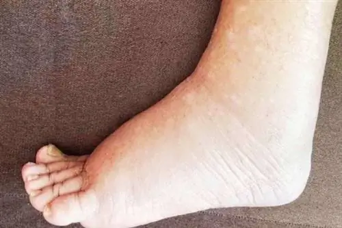 Нога, которая удерживает воду