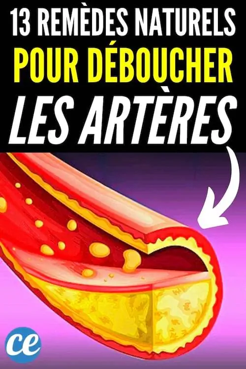 Как прочистить артерии, используя только 100% натуральные приемы?