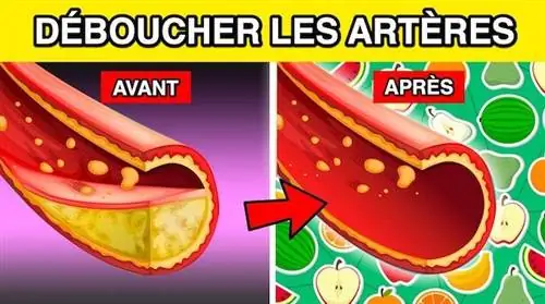 13 бабушкиных средств для естественного очищения артерий