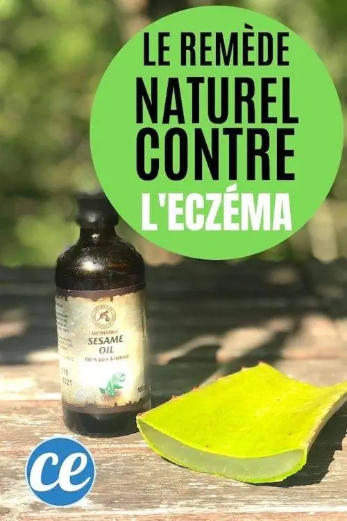 Алоэ вера и кунжутное масло как натуральное средство от экземы