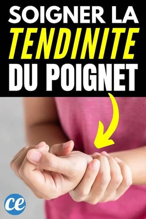 «Как вылечить теносиновит де Кервена или тендинит запястья?»