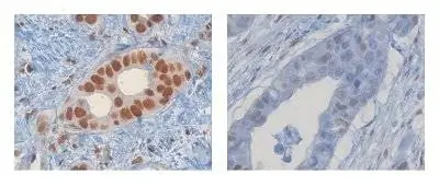 Технология Google помогает в исследованиях рака