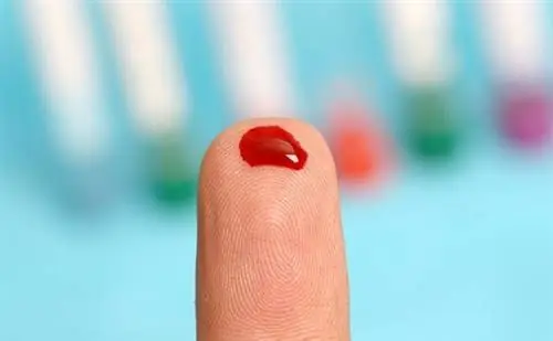 Экспресс-тест выявил заражение крови