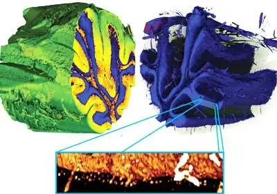 Рентгеновское зрение раскрывает детали мозга