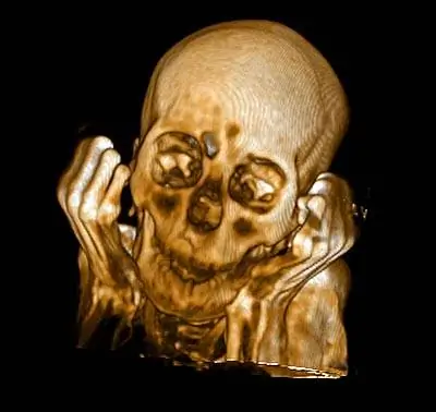 Мумии раскрывают секреты