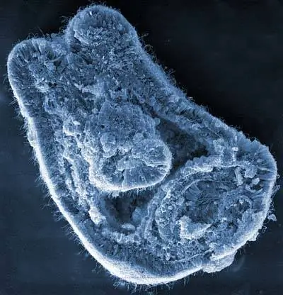 Человек и морской анемон больше похожи, чем ожидалось