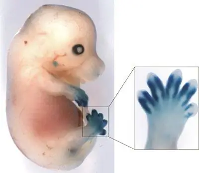 Дупликация ДНК уменьшает пальцы &8222;“