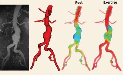 Виртуальная хирургия