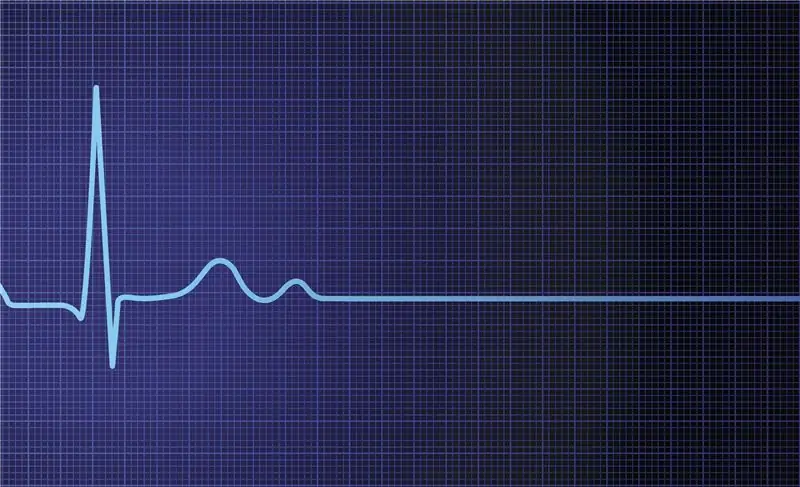 Как климатический кризис обрушит экономику