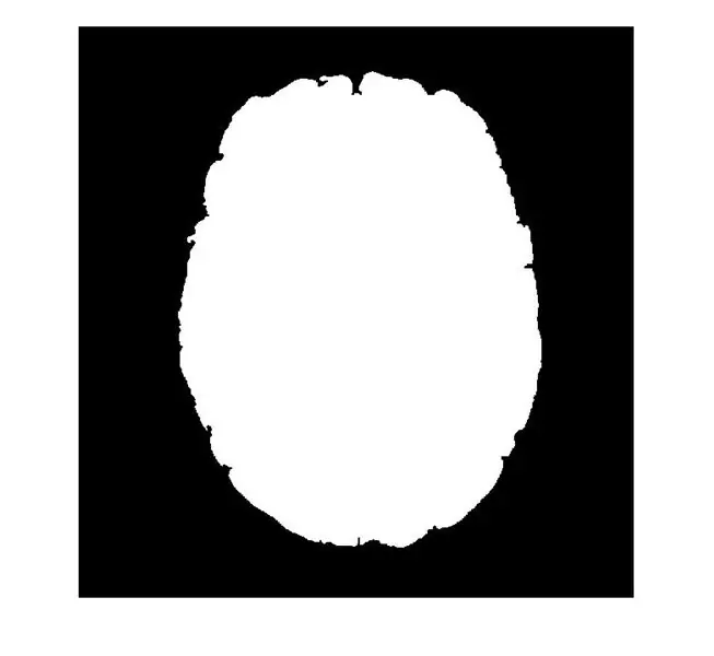 Обработка изображения и оценка анатомической информации