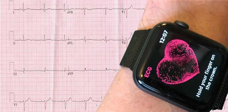 Имитация ЭКГ в 12 отведениях с помощью Apple Watch Series 4 или новее Имитация ЭКГ в 12 отведениях с помощью Apple Watch Series 4 или новее