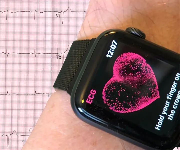 Моделирование ЭКГ в 12 отведениях с помощью Apple Watch Series 4 или новее: 14 шагов