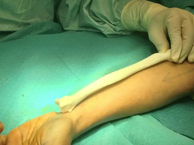 Ранджит Операция