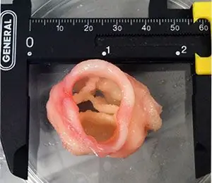 Создание ткани клапана с помощью 3D-биопечати Создание ткани клапана с помощью 3D-биопечати