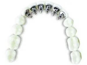 Riton Biomaterials eBrace 3D-печать Стоматология Riton Biomaterials eBrace 3D-печать Стоматология
