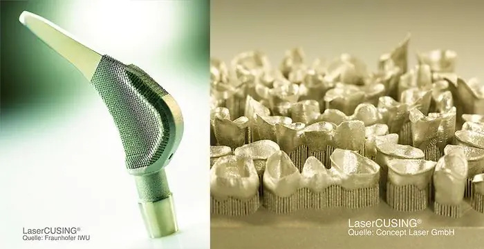 Лазерная концепция стоматологической 3D-печати Лазерная концепция стоматологической 3D-печати