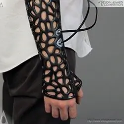 Osteoid Concept добавляет ультразвук в 3DP Cast
