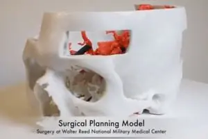 NIH 3D Print Exchange Медицинские модели для 3D-печати4 NIH 3D Print Exchange Медицинские модели для 3D-печати4