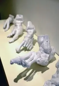 3D-печатные стопы для подготовки к операции 3D-печатные стопы для подготовки к операции