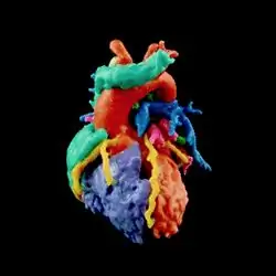 3D-печать вашего сердца с помощью моделей сердца от Materialise