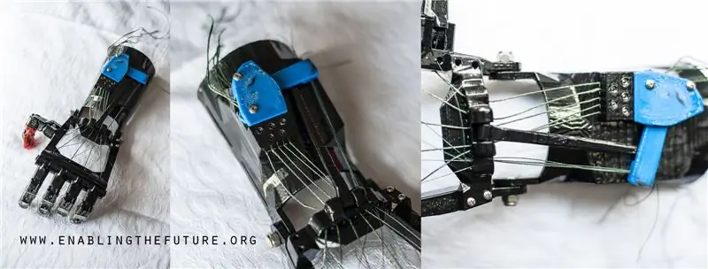 включить 3D-печатные протезы включить 3D-печатные протезы