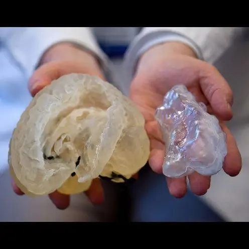 3D-печать поможет малышу Габриэлю в хирургии