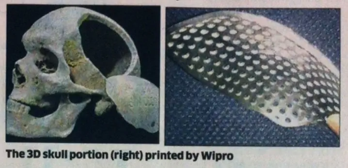 wipro 3d печать плиты черепа wipro 3d печать плиты черепа