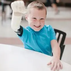 3DP Bionic Arm от Limbitless Solutions