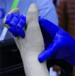 Open Bionics Реалистичная бионическая рука
