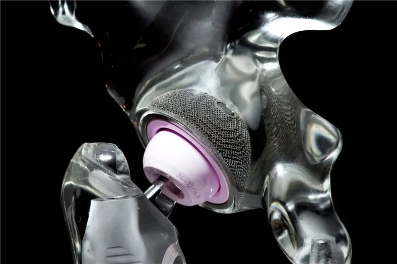 Распечатанный на 3D-принтере EBM тазобедренный сустав Lima Corporate «может прослужить всю жизнь»