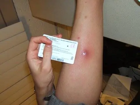 13 медицинских практик эпохи Возрождения, которые используются до сих пор