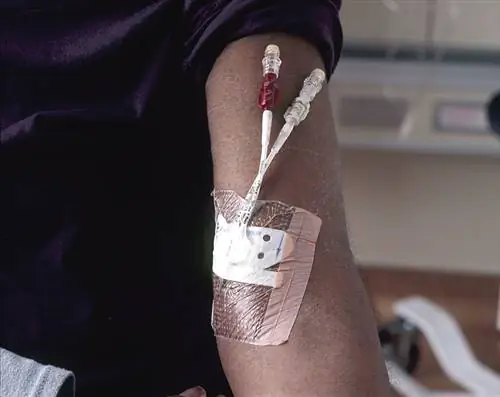 13 медицинских практик эпохи Возрождения, которые используются до сих пор