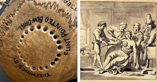 13 медицинских практик эпохи Возрождения, которые используются до сих пор