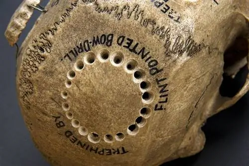 13 медицинских практик эпохи Возрождения, которые используются до сих пор