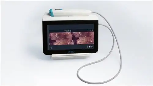 виртуальная биопсия