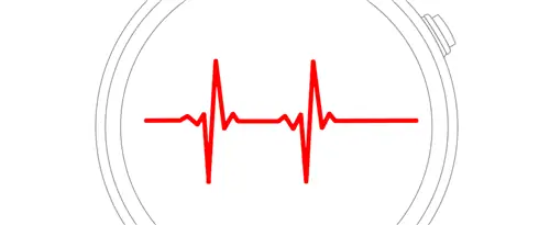 фотоплетизмография