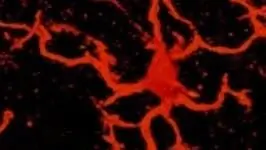 Невропатология: источник боли