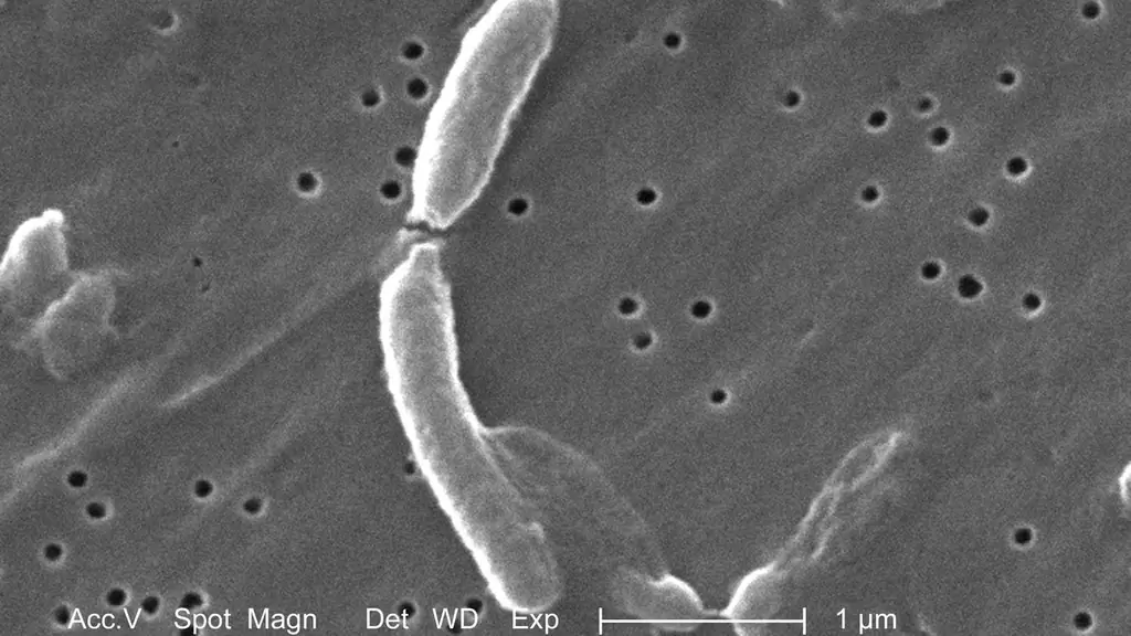 От холеры до короны