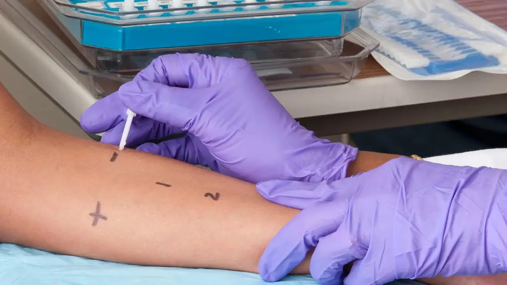 Самые важные вопросы и ответы о пищевой аллергии