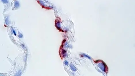 Цензура исследований: никакой цензуре науки во имя борьбы с биотерроризмом