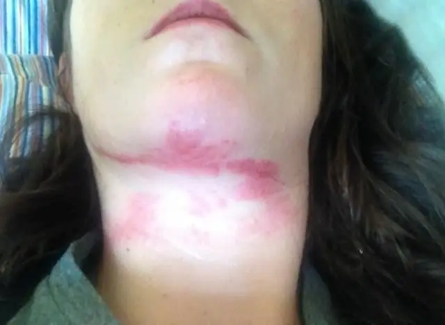 Убитый ирландский велосипедист призывает поймать детей, заложивших мины-ловушки