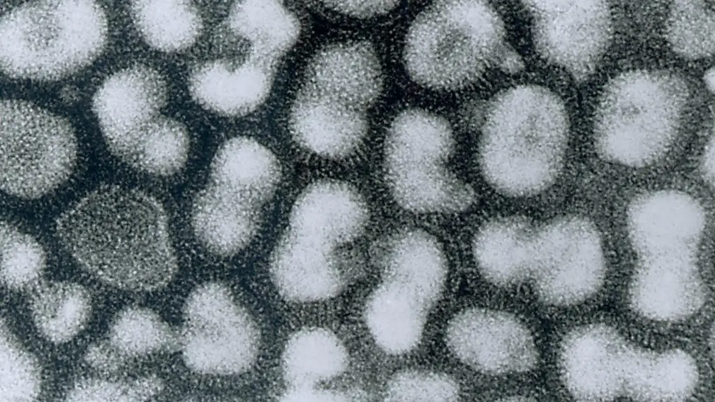 Птичий грипп: пять вопросов о H5N1