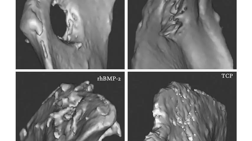 Медицина: микропористые керамические имплантаты лучше заживают переломы костей