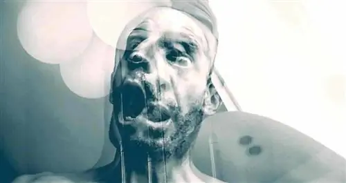 Обширные исследования ДНК выявили 10 генов, напрямую связанных с шизофренией