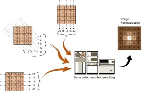 Пятьдесят лет назад первая компьютерная томография позволила врачам заглянуть внутрь живого черепа