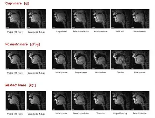 Битбоксер продемонстрировал три разных эффекта малого барабана, лежа на МРТ-сканере.